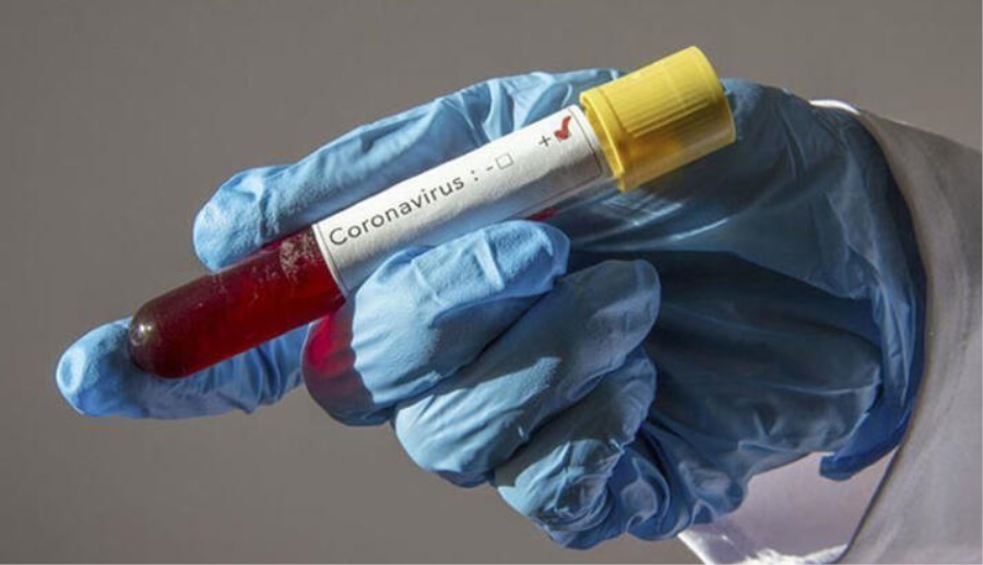 Türk doktordan büyük başarı: Koronavirüsü izole etti